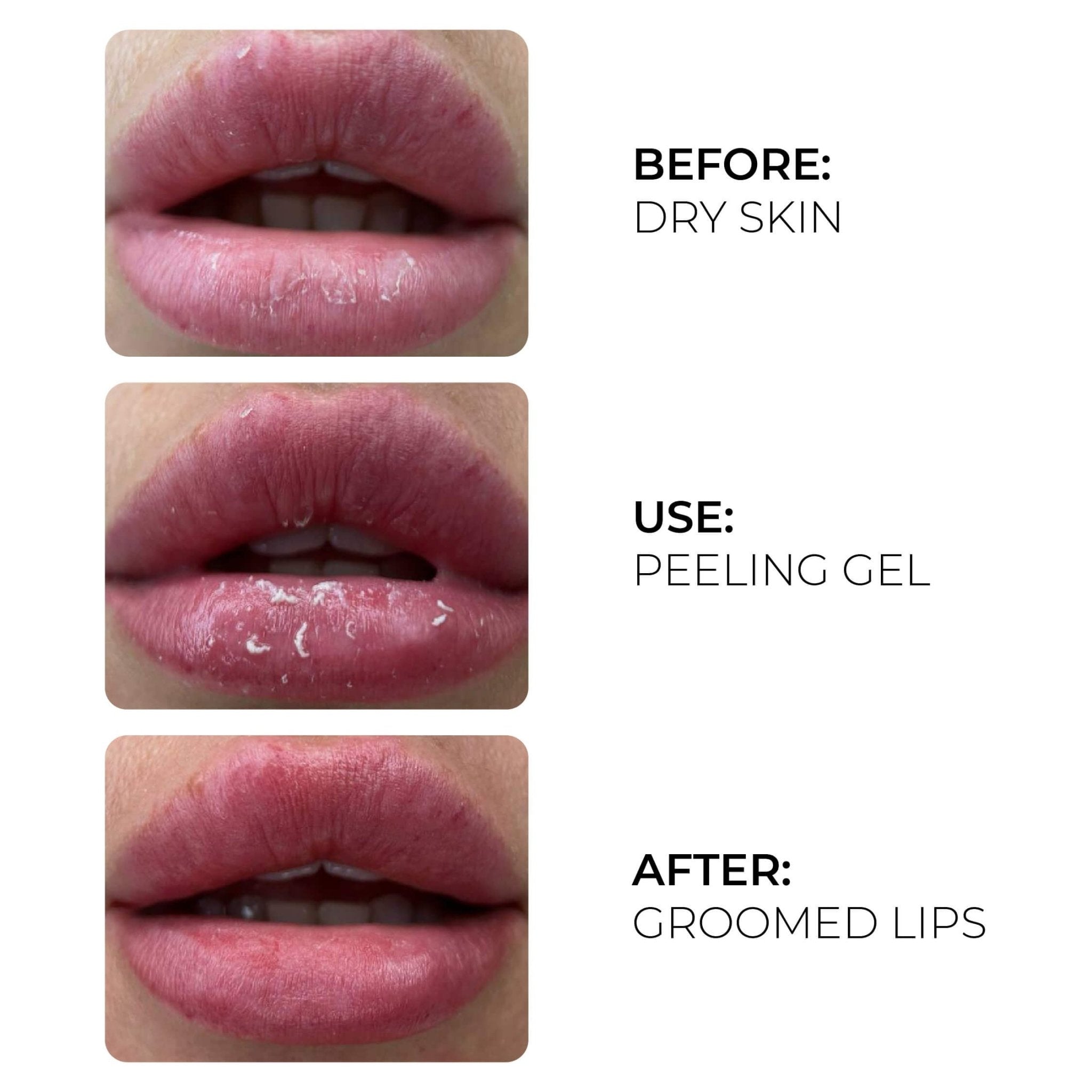 AS Pigments - Peeling Gel (Active Oxygen) / 17 ml - Mr.PMU